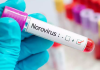 Why Norovirus Outbreaks Are Surging This Season: What You Need to Know Why Norovirus Outbreaks Are Surging This Season: What You Need to Know