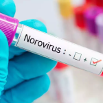 Why Norovirus Outbreaks Are Surging This Season: What You Need to Know Why Norovirus Outbreaks Are Surging This Season: What You Need to Know