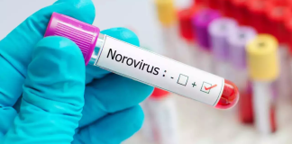 Why Norovirus Outbreaks Are Surging This Season: What You Need to Know Why Norovirus Outbreaks Are Surging This Season: What You Need to Know