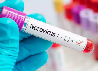 Why Norovirus Outbreaks Are Surging This Season: What You Need to Know Why Norovirus Outbreaks Are Surging This Season: What You Need to Know
