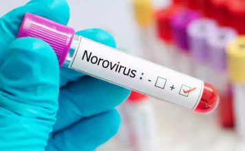 Why Norovirus Outbreaks Are Surging This Season: What You Need to Know Why Norovirus Outbreaks Are Surging This Season: What You Need to Know