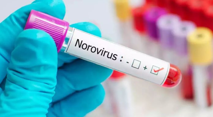 Why Norovirus Outbreaks Are Surging This Season: What You Need to Know Why Norovirus Outbreaks Are Surging This Season: What You Need to Know